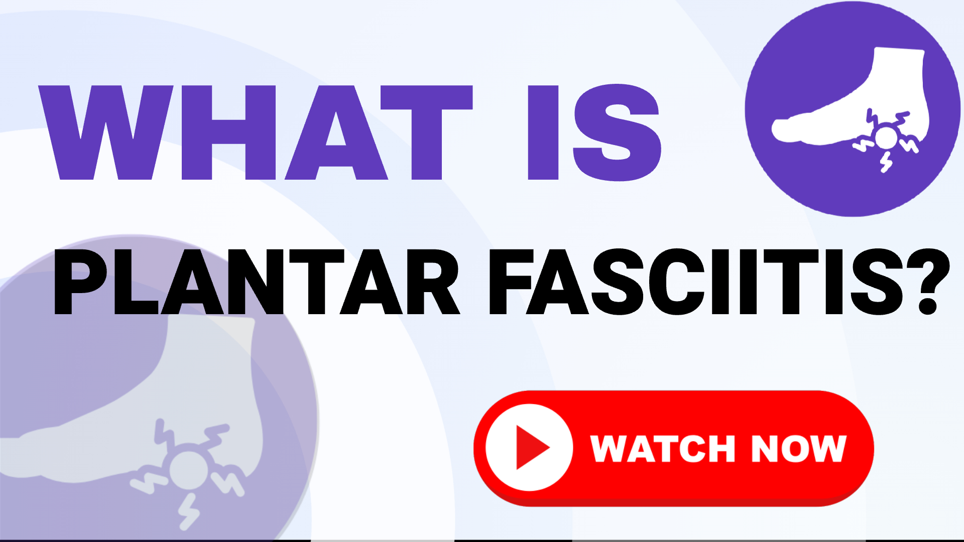 Plantar Fasciitis